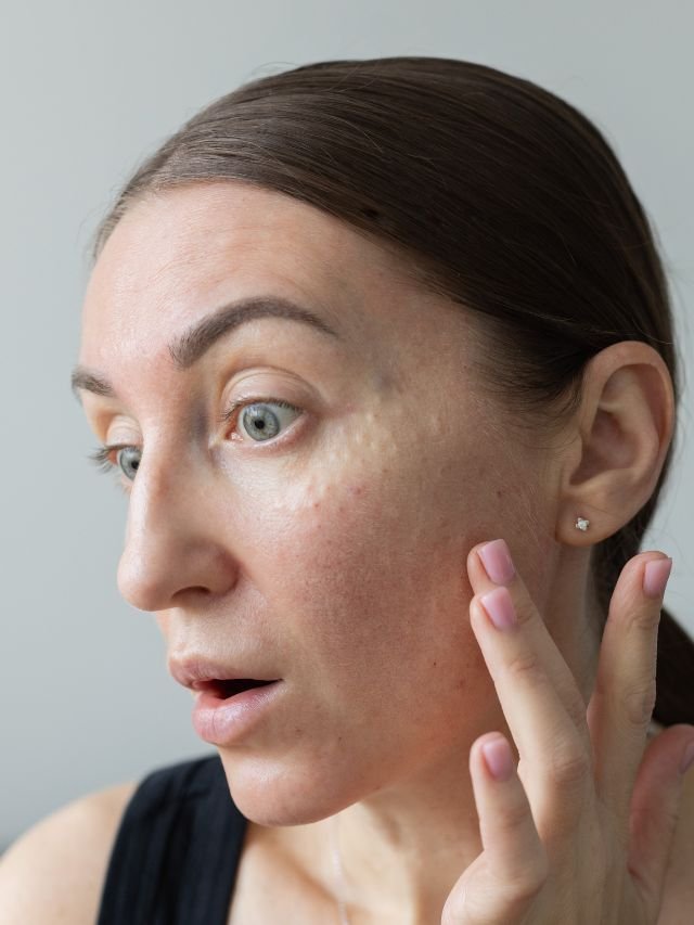 Como retomar o skincare após desistir por frustração?