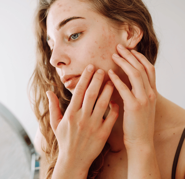 Por que sua pele nunca parece limpa de verdade dominando a make maquiagem batom blush geane sousa capa Web Stories