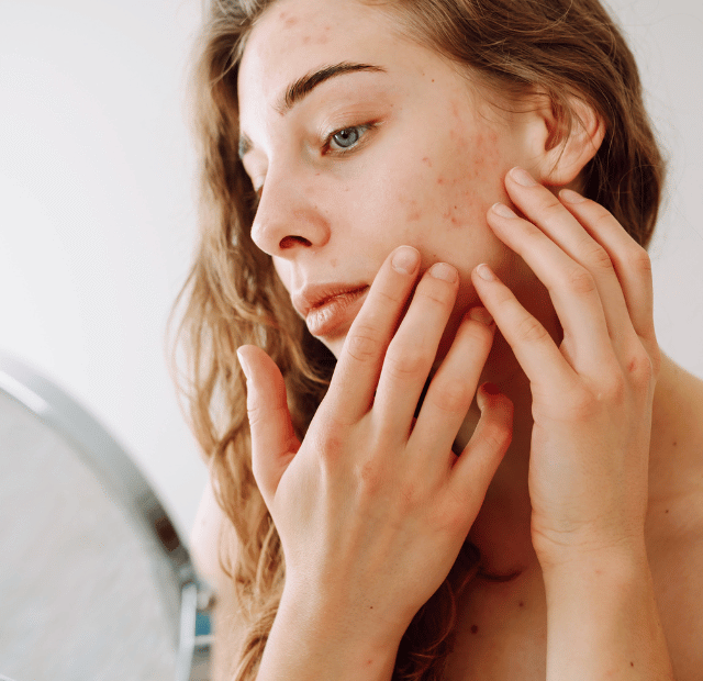 Por que sua pele parece sem vida, dominando a make maquiagem batom blush geane sousa capa Web Stories