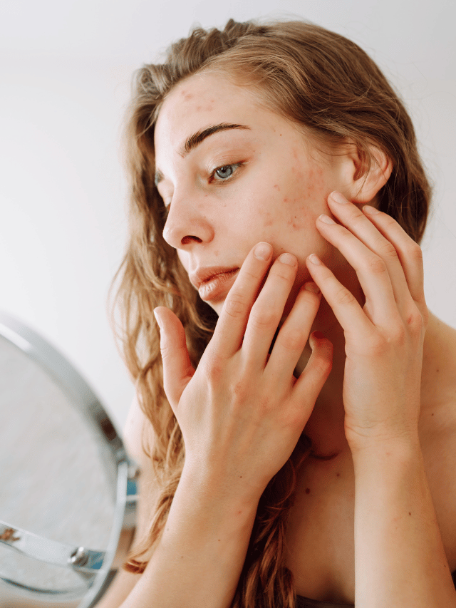 Por que sua pele parece sem vida?